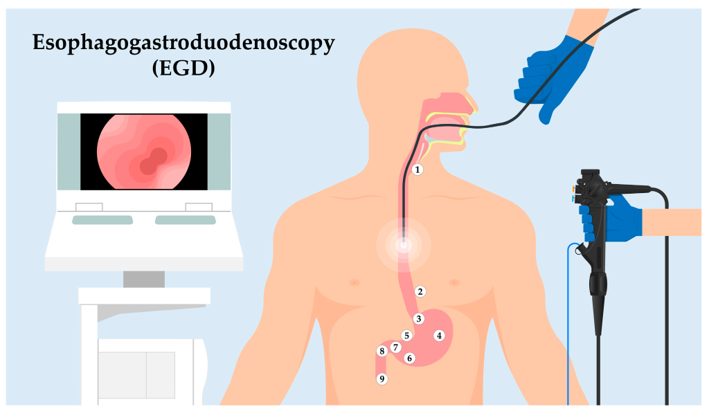 Esophagoscopy scaled